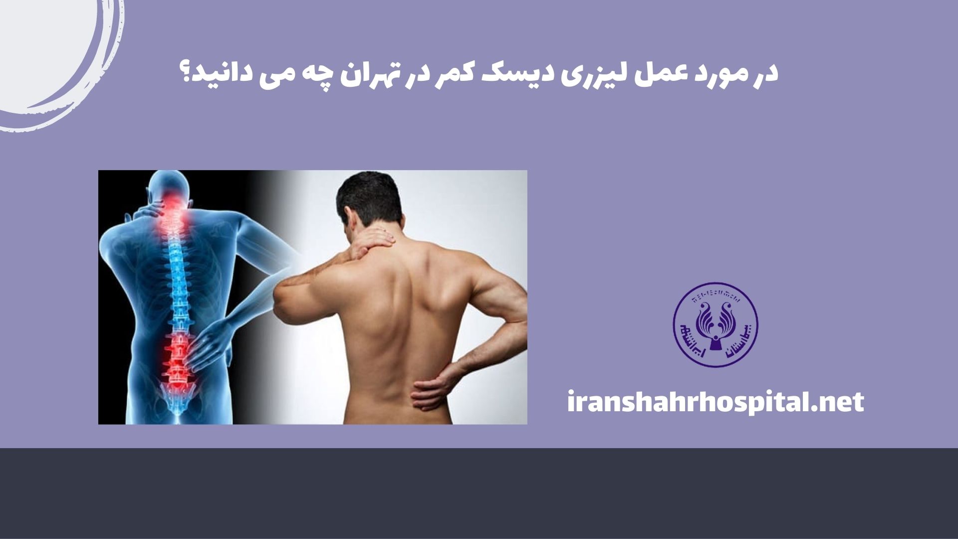 در مورد عمل لیزری دیسک کمر در تهران چه می دانید؟