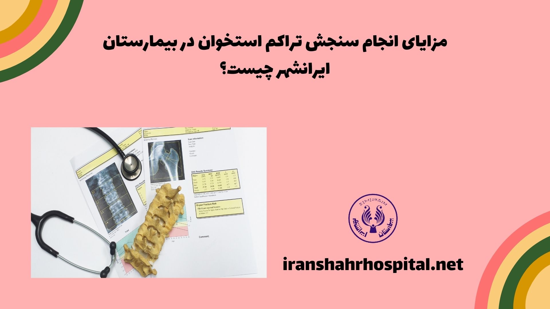 مزایای انجام سنجش تراکم استخوان در بیمارستان ایرانشهر چیست؟