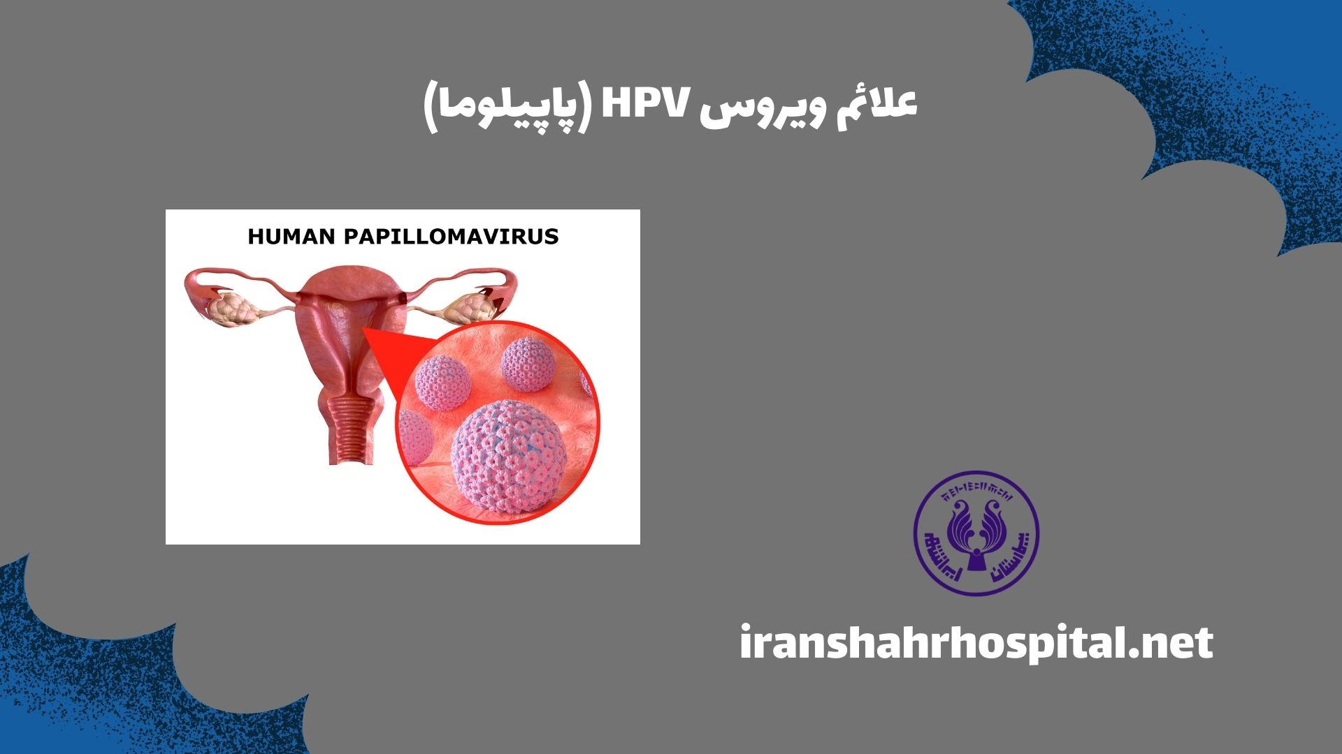 علائم ویروس HPV (پاپیلوما)