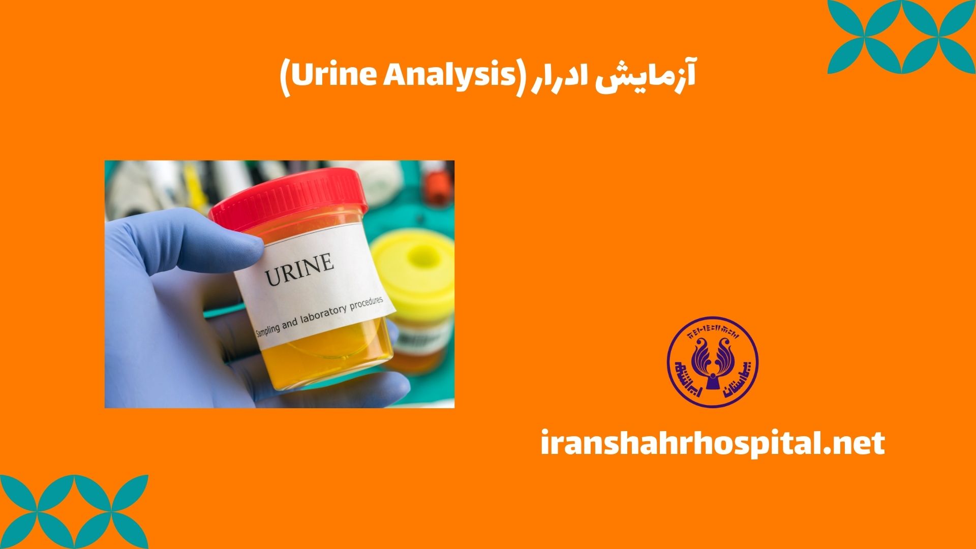 آزمایش ادرار (Urine Analysis)