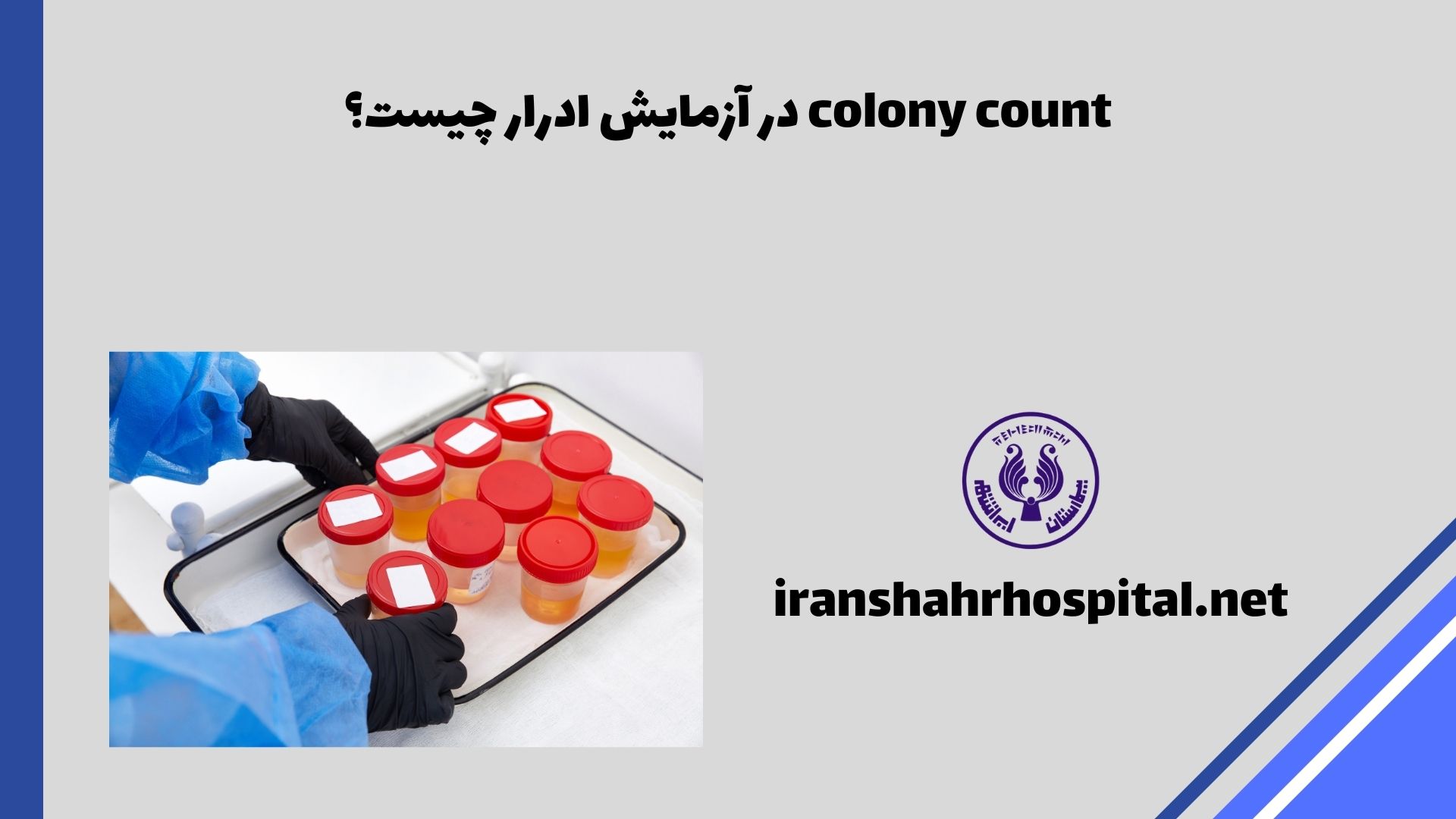colony count در آزمایش ادرار چیست؟