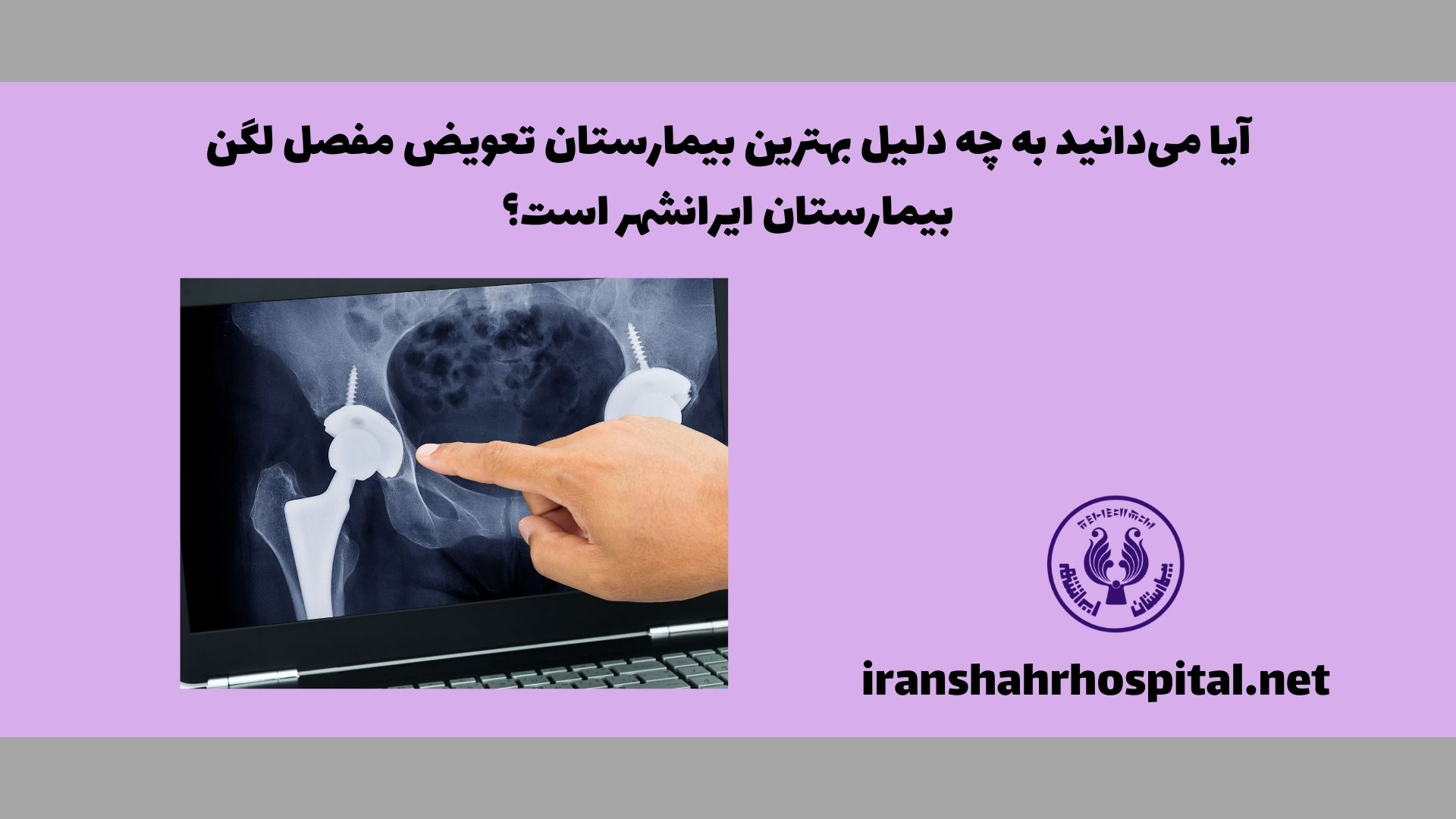 آیا می‌دانید به چه دلیل بیمارستان ایرانشهر، بهترین بیمارستان تعویض مفصل لگن شناخته شده است؟