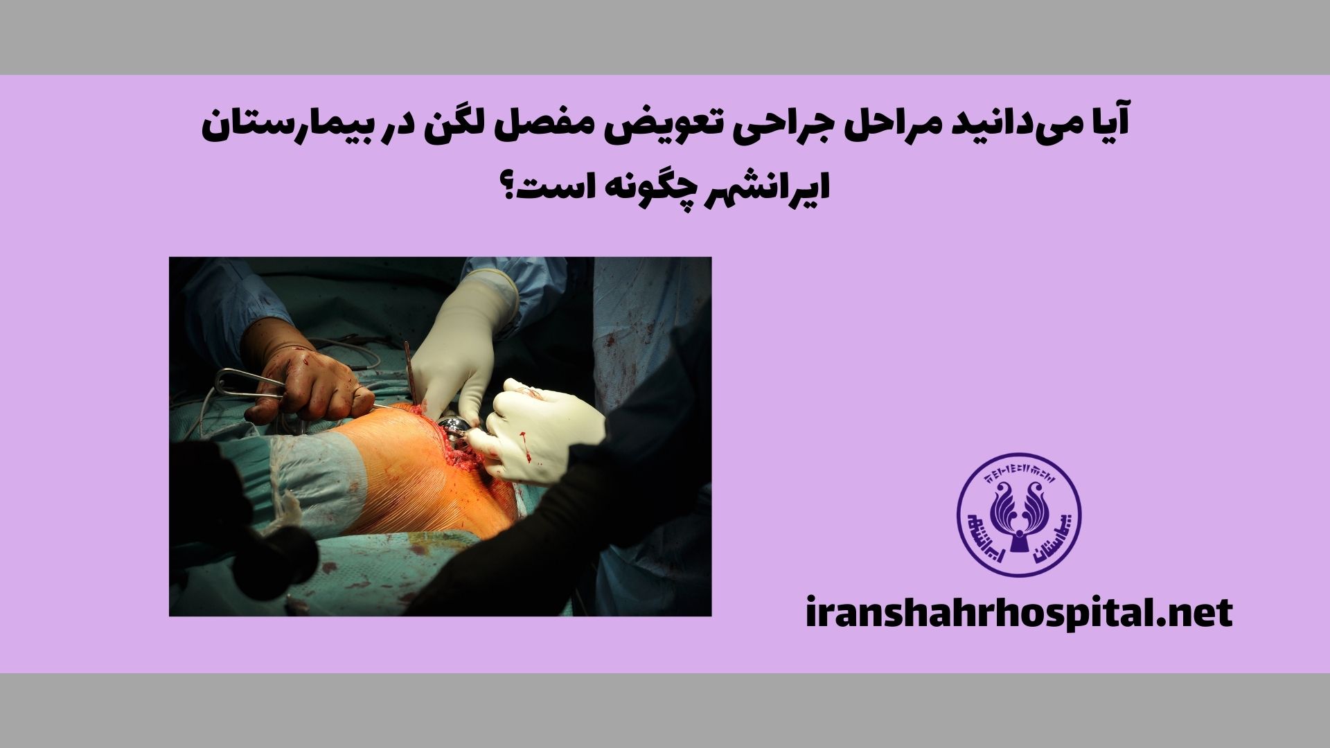 آیا می‌دانید مراحل جراحی تعویض مفصل لگن در بیمارستان ایرانشهر چگونه است؟