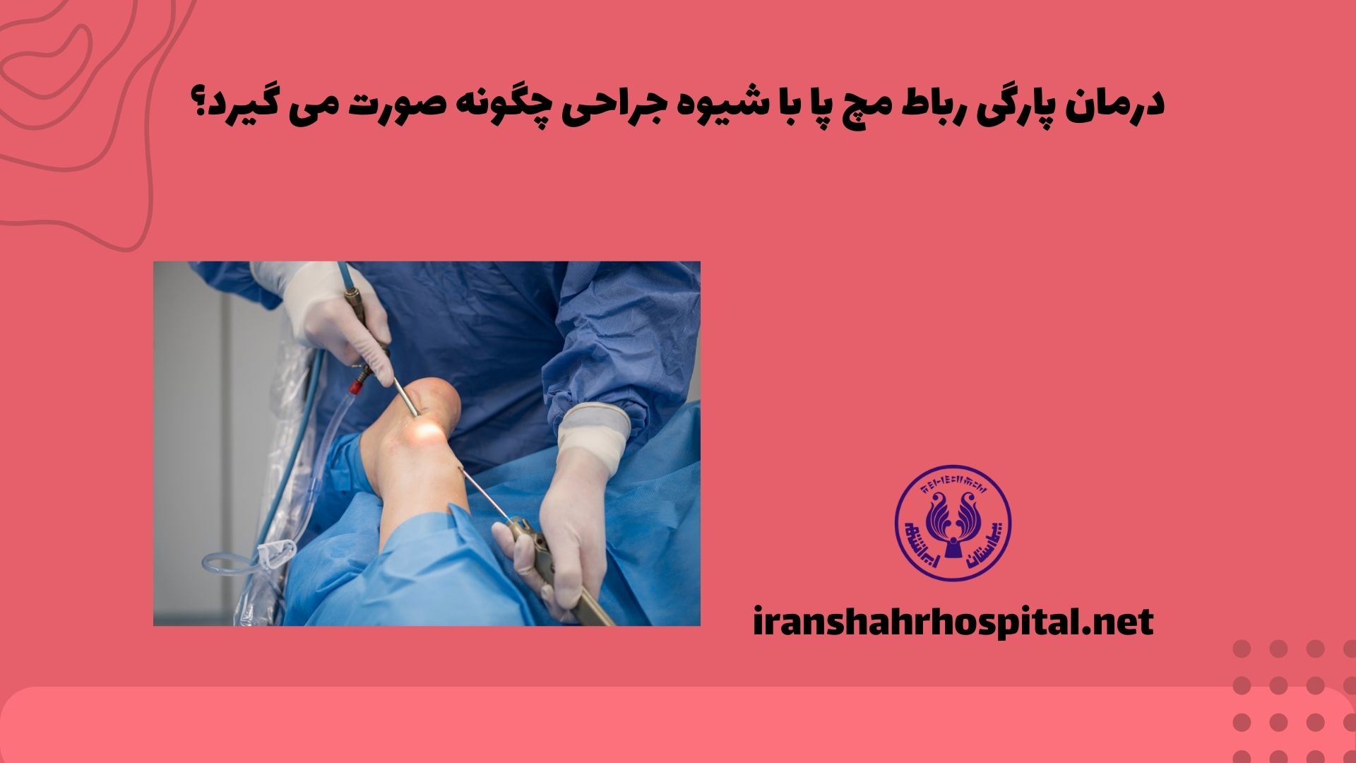 درمان پارگی رباط مچ پا با شیوه جراحی چگونه صورت می گیرد؟