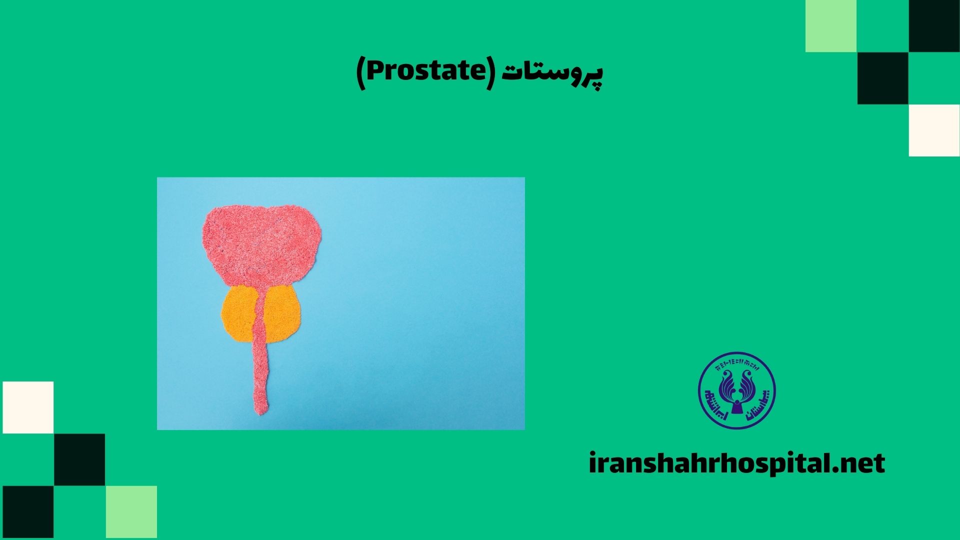 پروستات Prostate