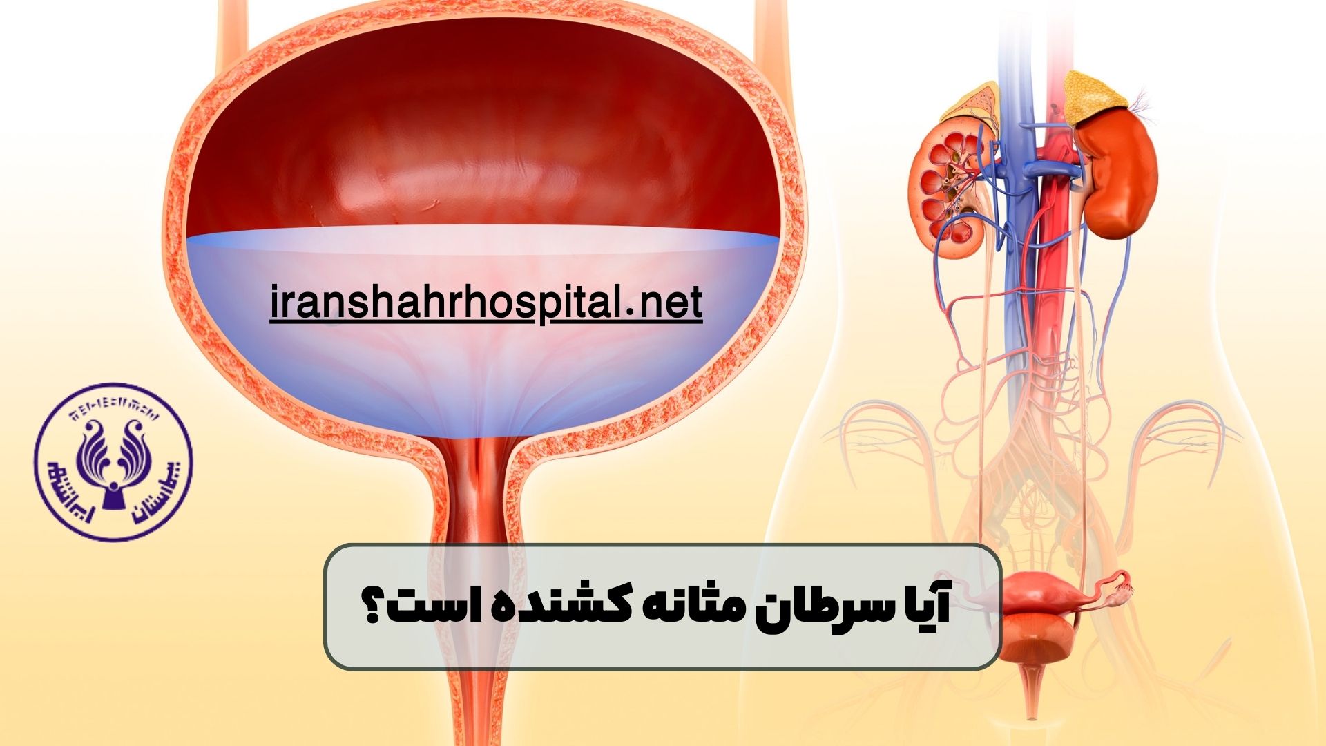 آیا سرطان مثانه کشنده است؟ درمان سرطان مثانه 👨‍⚕️